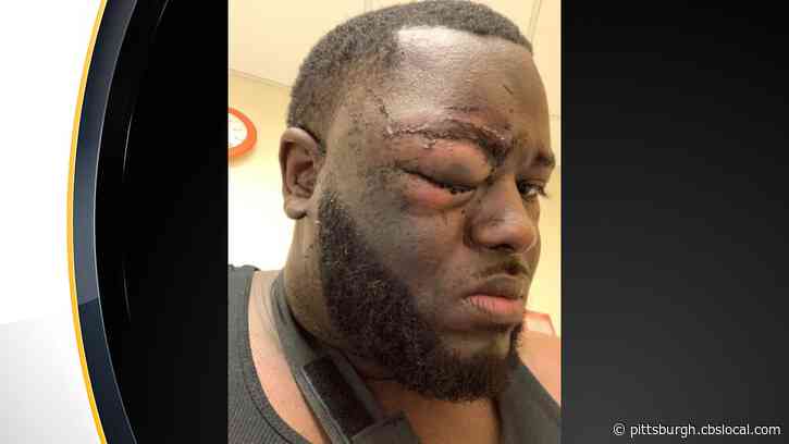 ‘Aaron Donald Was On Mr. Spriggs’ Side:’ Donald’s Defense Attorney Claims He Broke Up Fight