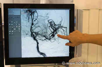 Doctors on alert for rare blood clots linked to J&J vaccine