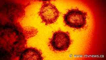 U.S. study identifies the genes that fight coronavirus infections - CTV News