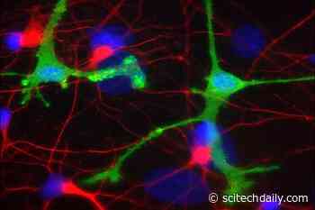Experimental Antibodies for Parkinson’s and Alzheimer’s May Cause Harmful Inflammation