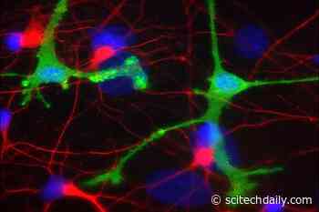 Experimental Antibodies for Parkinson’s and Alzheimer’s May Cause Harmful Inflammation