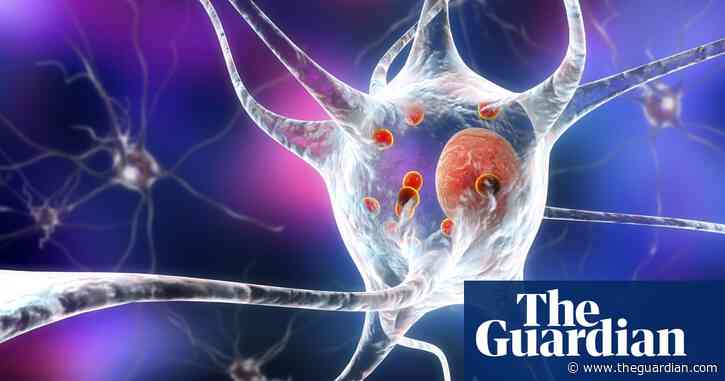 Caring for a loved one with Parkinson’s and Lewy body dementia | Letter