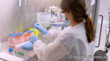 'We'll have to watch closely': Sask. physician urging caution with the introduction of the P.1 variant