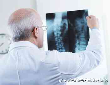 After accident, patient crashes into $700,000 bill for spine surgery