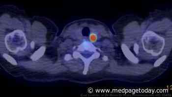 Surveillance Spurned for Small Papillary Thyroid Tumors