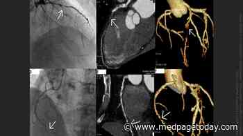 Complete Coronary Revascularization: One Definition to Unite Them All?
