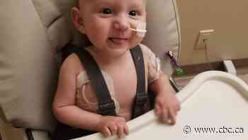 Toronto surgeons give Winnipeg baby another shot at life after removing nearly 3-pound tumour - CBC.ca