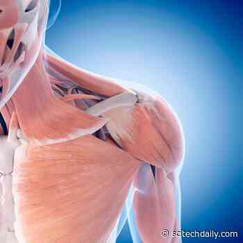 Critical Muscle Gene Linked to Type 2 Diabetes