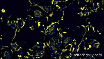Pesticide Exposure May Increase COVID-19 Susceptibility