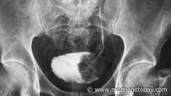 What to Do With a Rare, Aggressive Bladder Cancer