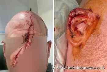 Man 'knocked unconscious' by badger baiters in horrific Bolton attack