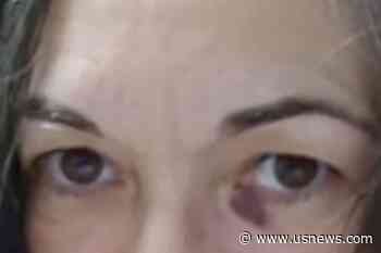 Ghislaine Maxwell Shown With 'Black Eye' in Photo -Lawyer