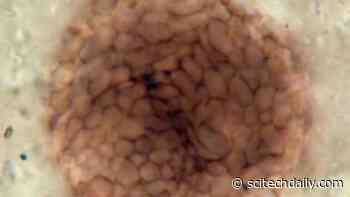 Billion-Year-Old Fossil Discovered – Reveals Missing Link in the Evolution of Animals