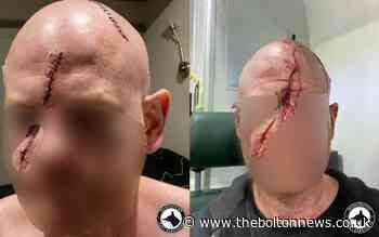 Police appeal after attack on man in Bolton - The Bolton News
