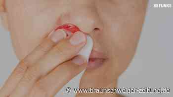 Häufiges Nasenbluten? So lässt sich vorbeugen!