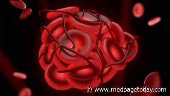 Post-Vax Clot Case Supports Angiomax Use
