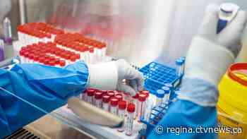 Sask. records 295 new COVID-19 cases, identifies 210 more variant cases