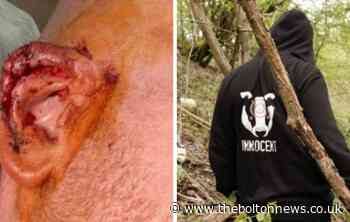 Watch group praises man who confronted badger baiters in Bolton