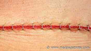Op-Ed: Why the COVID Vaccine Didn't Work for Me