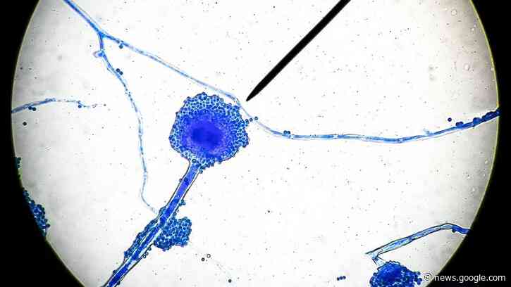 Potentially fatal 'black fungus' infections on the rise in India's COVID-19 patients - Livescience.com
