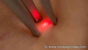 No Clarity for Role of Laser Therapy in Vulvar Lichen Sclerosus