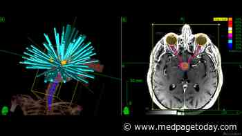 SRS Proves Promising for Brainstem Metastases
