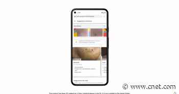 Google shows Derm Assist for skin cancer detection video     - CNET