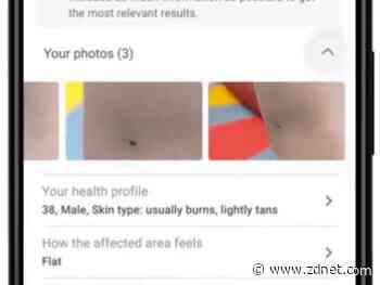 Google I/O 2021: An AI model to diagnose dermatological dilemmas