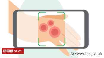 Google AI tool can help patients identify skin conditions