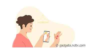 Google I/O 2021: Google Health’s New AI Tools Can Identify Common Skin Problems, Potential TB Patients