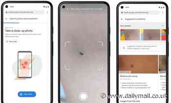 Google unveils AI tool that can identify 288 skin conditions