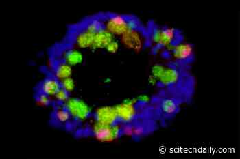 Eating a Western Diet Impairs the Immune System in the Gut – May Increase Risk of Inflammation, Infection