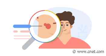 Google will help you identify that suspicious mole or rash     - CNET