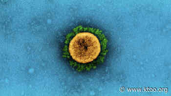 Alaska sees sharp spike in coronavirus cases stemming from variant first found in Britain - KTOO