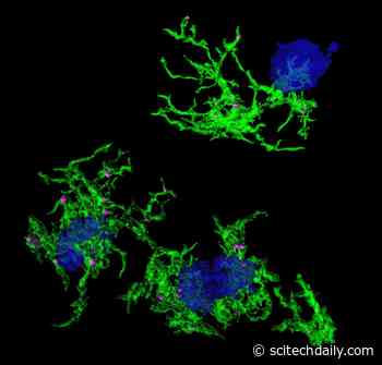 Gene Signature Discovered for Plaque-Eating Microglia in Alzheimer’s Disease