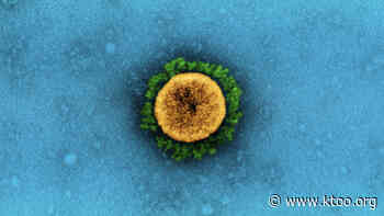 ALASKA Alaska sees sharp spike in coronavirus cases stemming from variant first found in Britain KTOO - KTOO