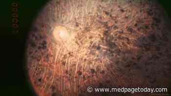 Optogenetic Tx Partially Restores Vision in Blind Man After 40 Years
