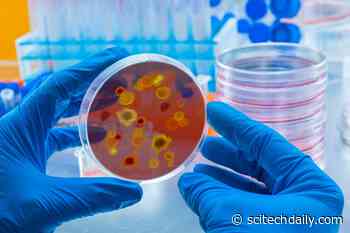 Global Dengue Virus Infections Far Surpass COVID-19 – New Discovery Could Aid Vaccine Development