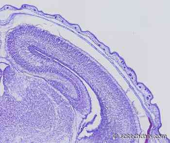 Defective Gene Slows Down Brain Cells: High-Risk Gene for Developing Autism