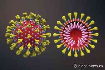 COVID-19: Saskatchewan reports 6 new deaths, 118 new cases