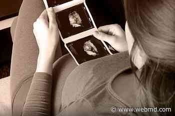 Woman Sues Fertility Doctor, Alleges 'Medical Rape' - WebMD