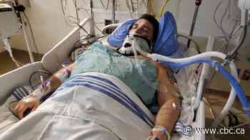 Studies reveal the unintended consequences of delaying surgeries, drop in ER visits due to pandemic