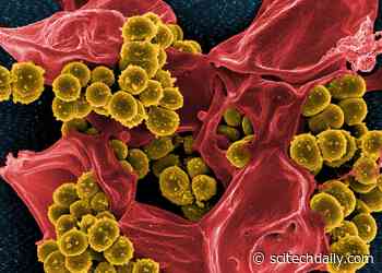 Staphylococcus: From Harmless Skin Bacteria to Deadly Pathogen
