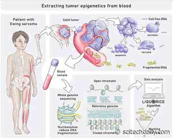 New Blood Test Detects Childhood Tumors Based on Their Epigenetic Profiles