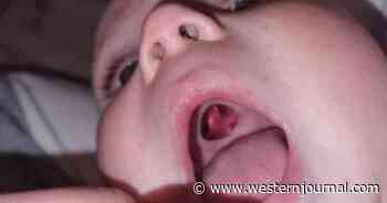 Mom Rushes to ER After Finding 'Hole' in Roof of Baby's Mouth; Nurse Shines a Pen Light on It and Knows Instantly What to Do