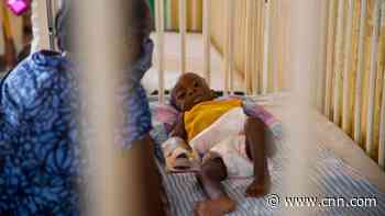 Child malnutrition is spiking in Haiti amid pandemic, says UNICEF