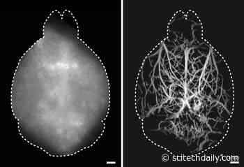 New Microscopy Technique Reaches Deeper Into the Living Brain