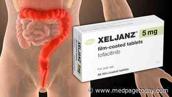 Tofacitinib May Cut Colectomy Risk in Hospitalized, Severe UC