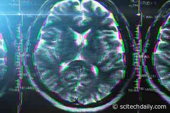 Regular Caffeine Consumption – From Coffee, Cola, or Energy Drinks – Affects Brain Structure