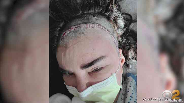 ‘It Was Divine Intervention’: NY Mother Judy Tedesco Survives 3 Brain Aneurysms — Discovered By Accident